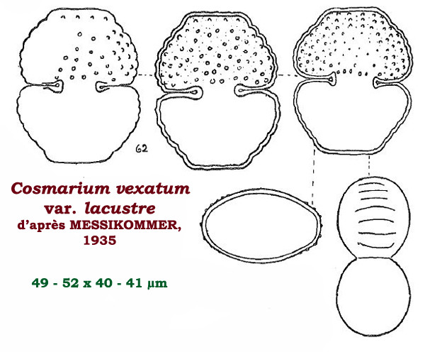 Cosmarium vexatiforme F.A.C.Kouwets #86323