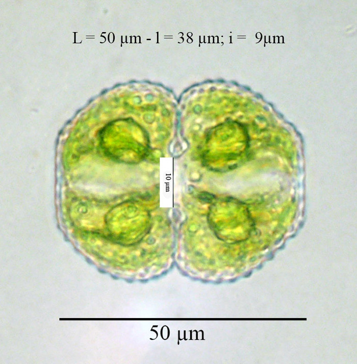 Cosmarium vexatum W. West, 1892 #86261