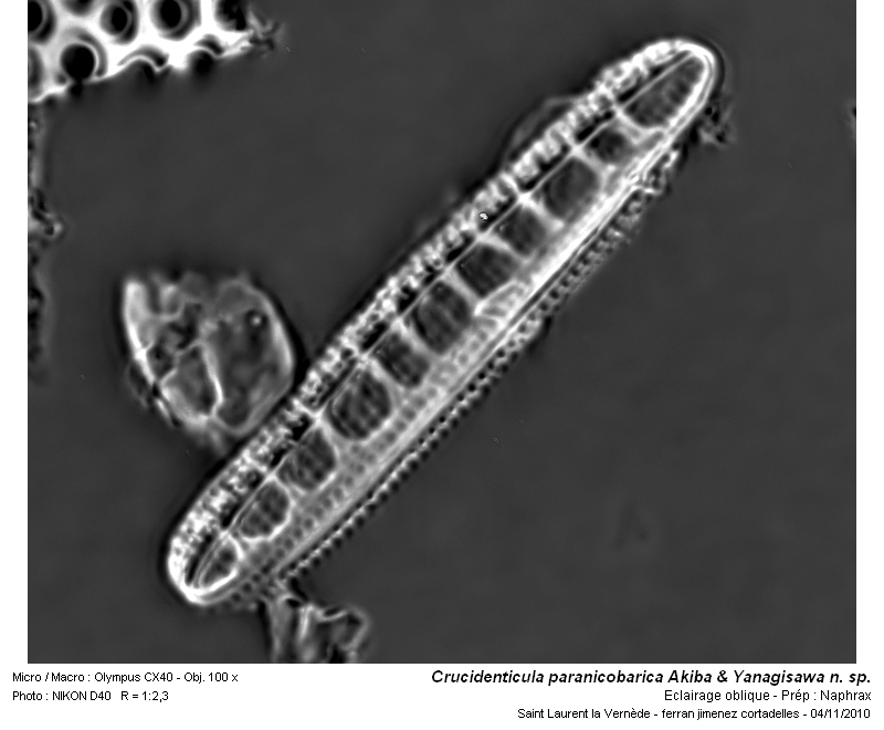 Crucidenticula paranicobarica Akiba &Yanagisawa n. sp. #19106