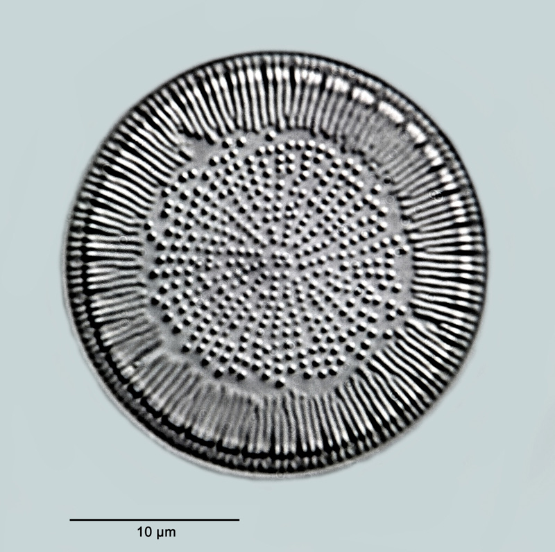 Cyclotella bodanica var. aff. affinis Grunow #30103