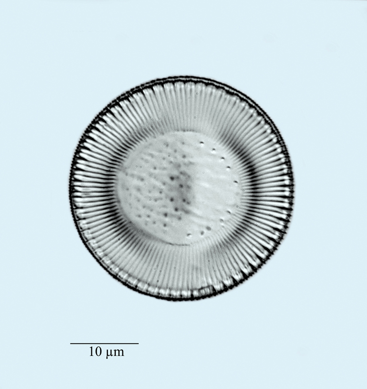 Cyclotella bodanica #47765