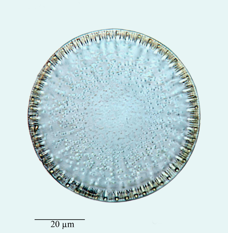 Cyclotella castracanii #64574