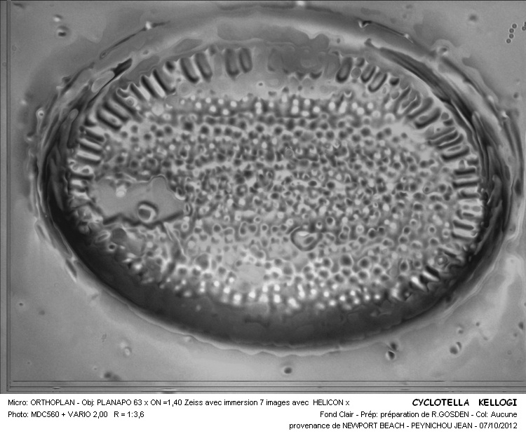 CYCLOTELLA KELLOGGI #32161