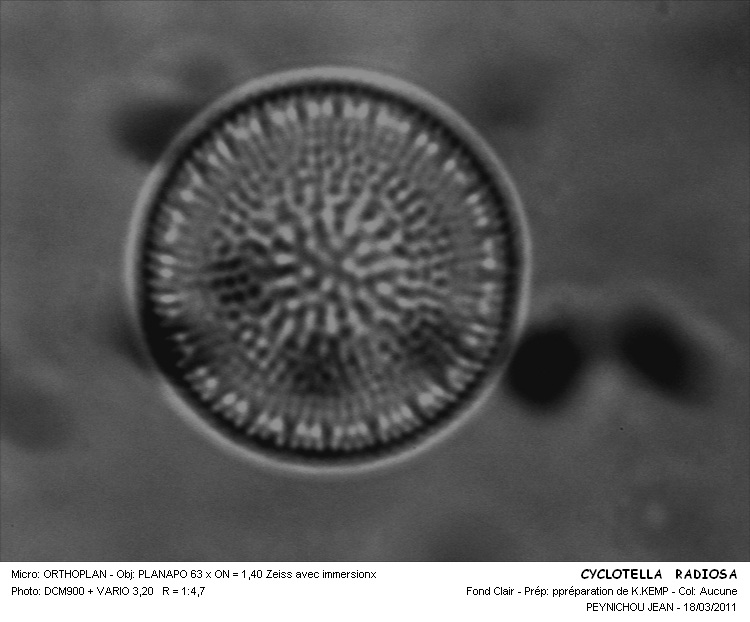 CYCLOTELLA RADIOSA #32156