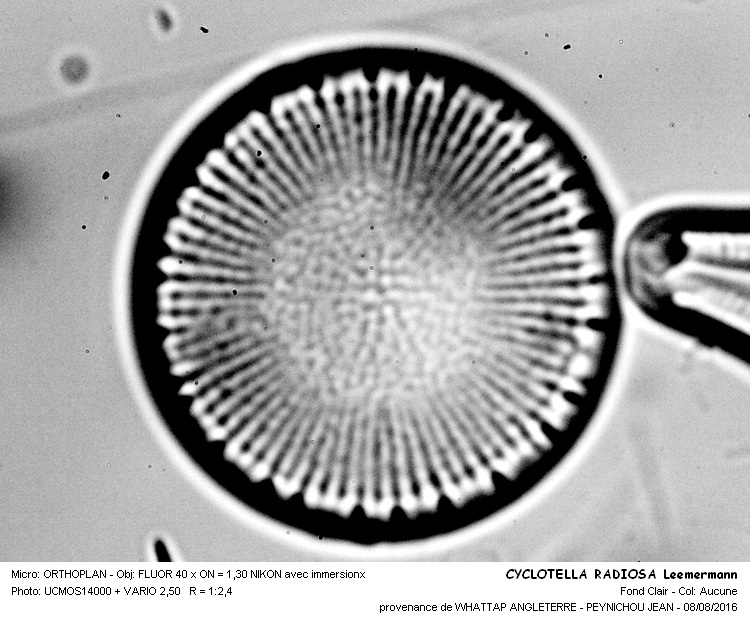 CYCLOTELLA RADIOSA Leemermann #46399