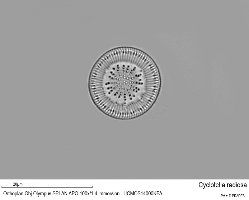 Cyclotella radiosa #48172