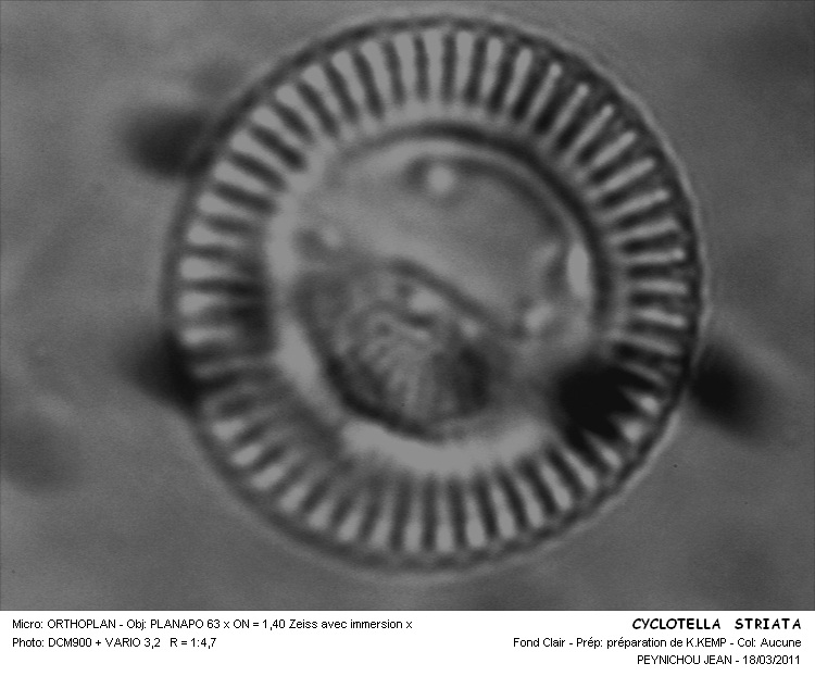 CYCLOTELLA STRIATA #32155