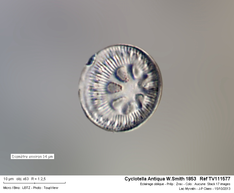 Cyclotella W.Smith #35198