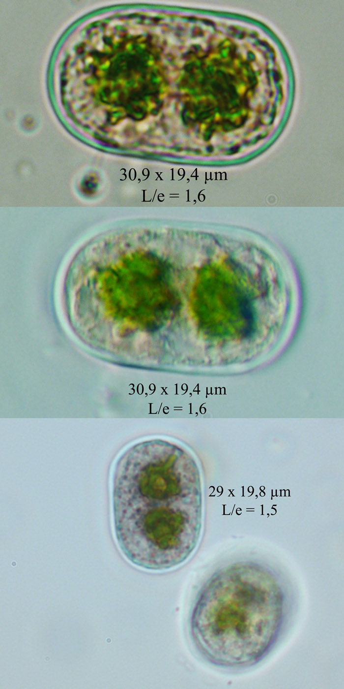 Cylindrocystis crassa #68779