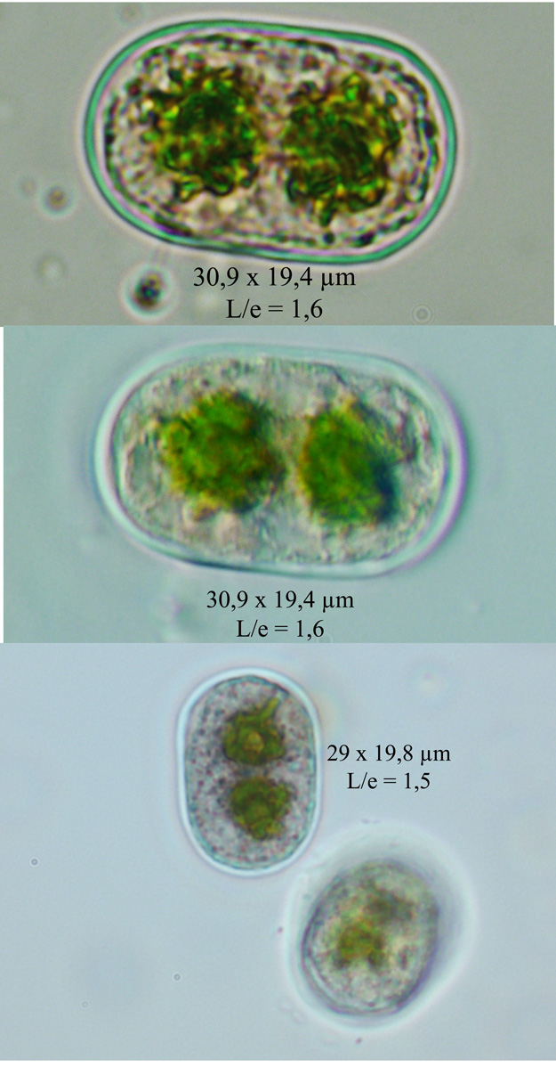 Cylindrocystis crassa #60931