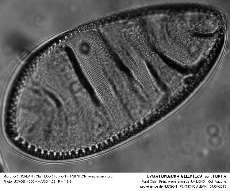 Cymatopleura Elliptica var.Torta #30755