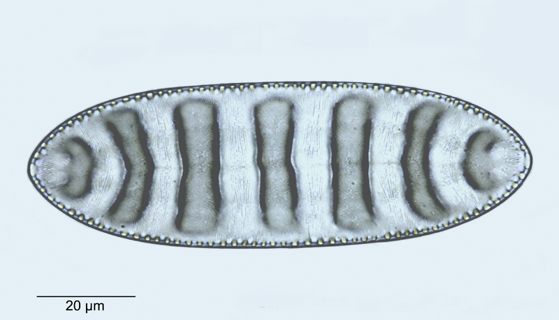 Cymatopleura elliptica #49921