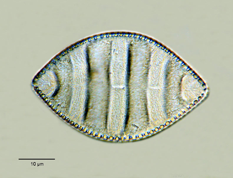Cymatopleura elliptica var. hibernica (W.Smith) Van Heurck #7763