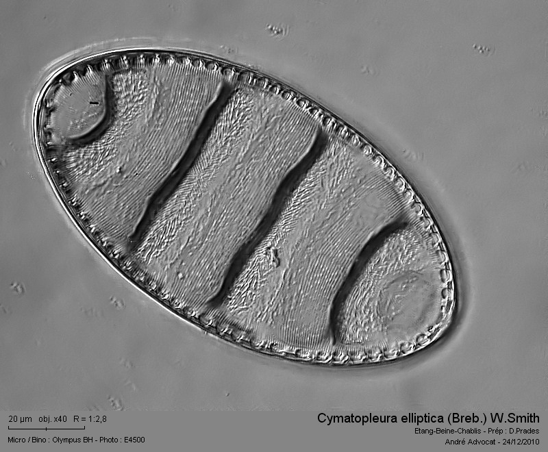 Cymatopleura elliptica (Breb.) W.Smith #19765
