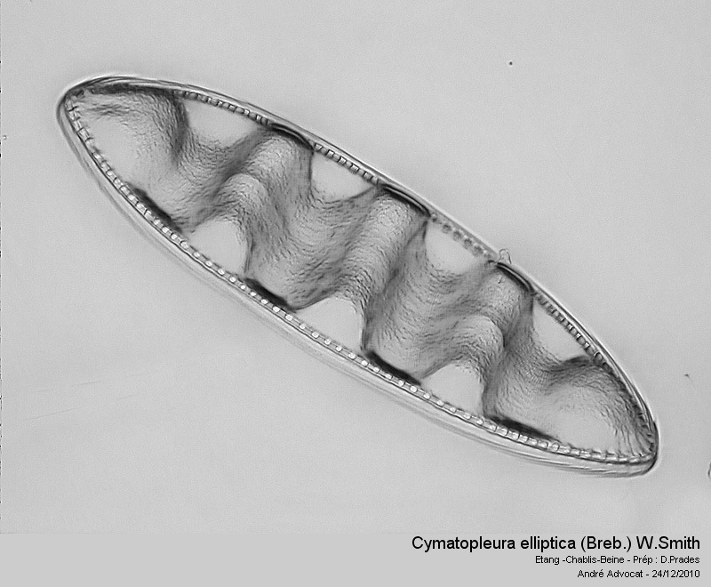 Cymatopleura elliptica (Breb.) W.Smith #19762