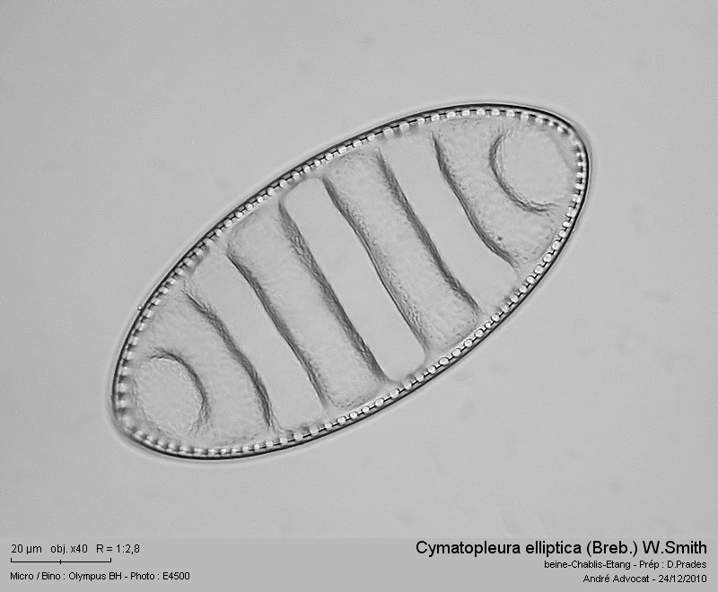 Cymatopleura elliptica (Breb.) W.Smith #19763