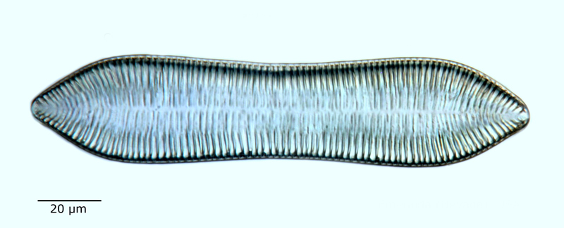 Cymatopleura librile #60371