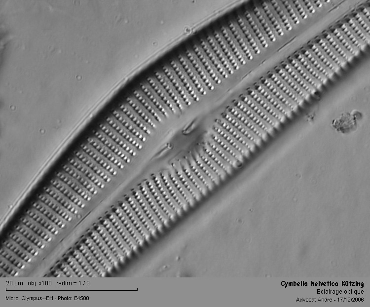 Cymbella helvetica Kützing 1844 #567