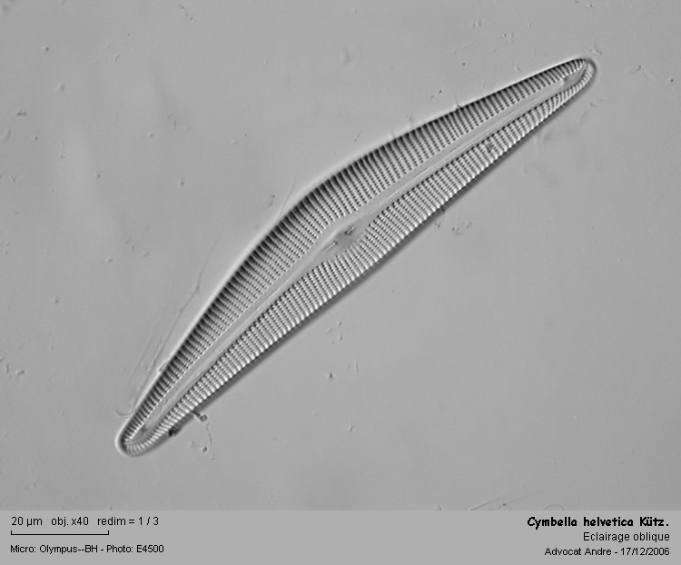 Cymbella helvetica Kützing 1844 #565