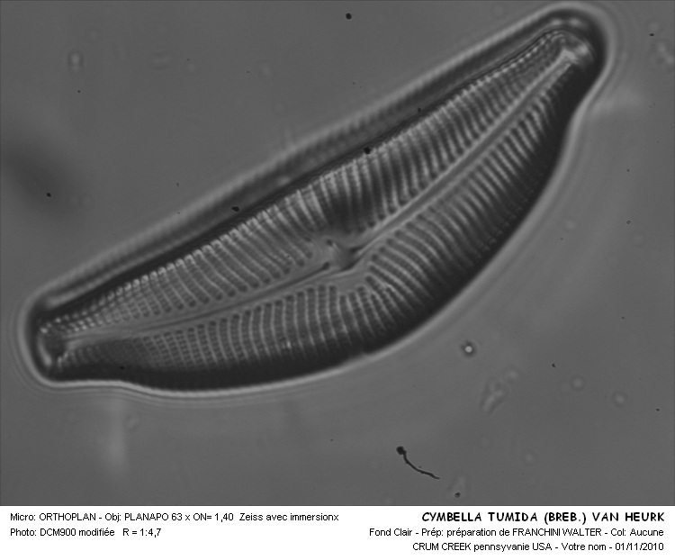 CYMBELLA TUMIDA Breb. VAN HEURK #32113