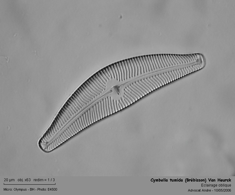 Cymbella tumida (Brébisson) Van Heurck #2536