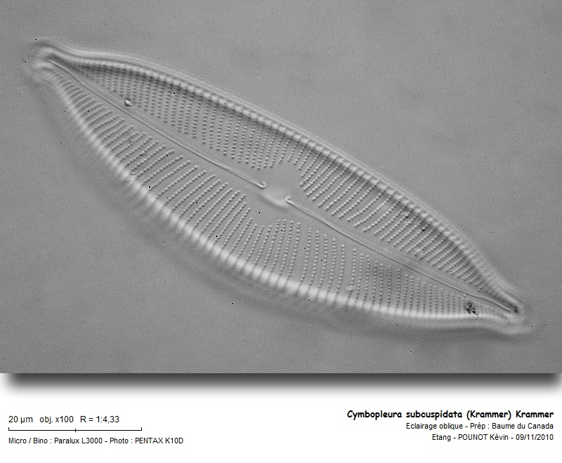 Cymbopleura subcuspidata (Krammer) Krammer #18987