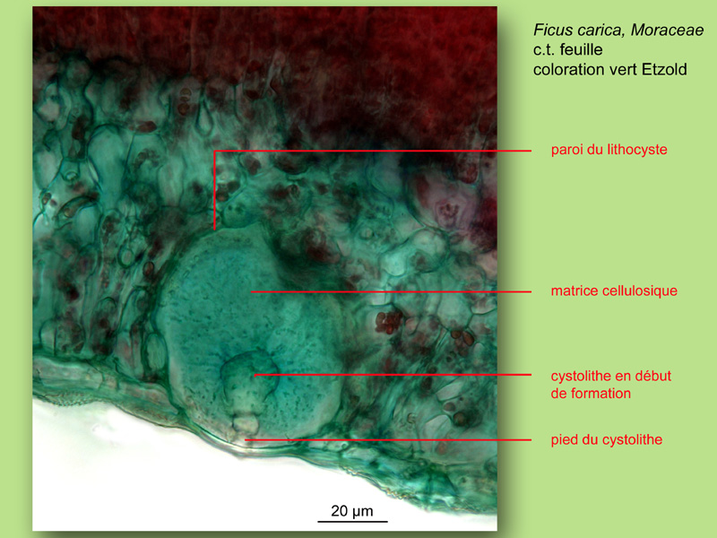 Cystolithes, lithocystes, histologie, histology #24002