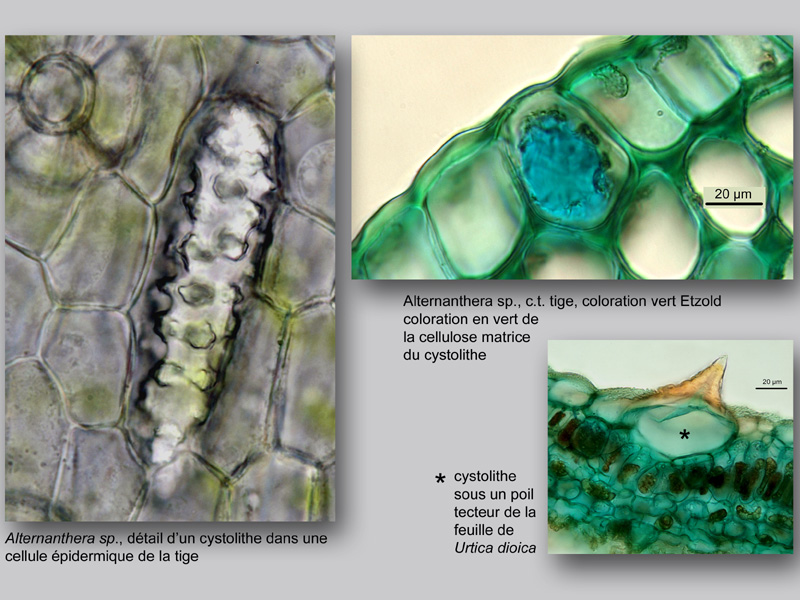 Cystolithes, lithocystes, histologie, histology #24004