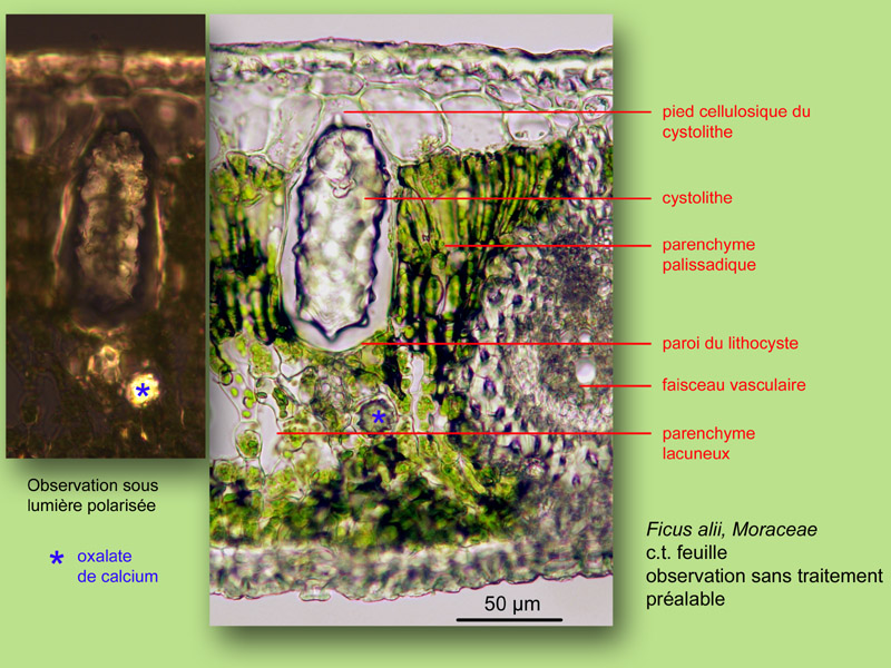 Cystolithes, lithocystes, histologie, histology #24001
