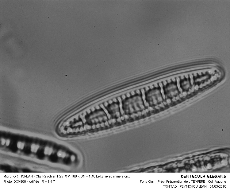 Denticula elegans #32110
