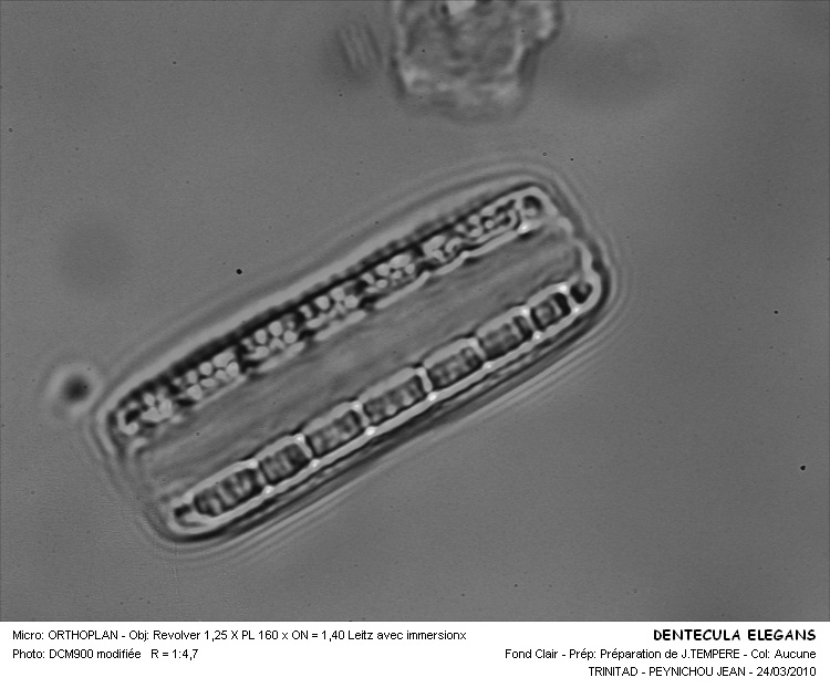 Denticula elegans #32111
