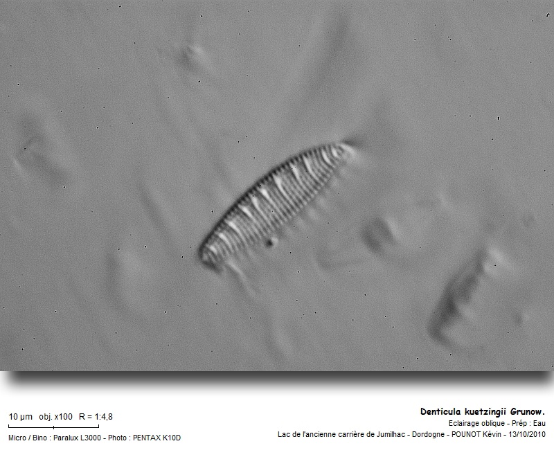 Denticula kuetzingii Grunow #18550