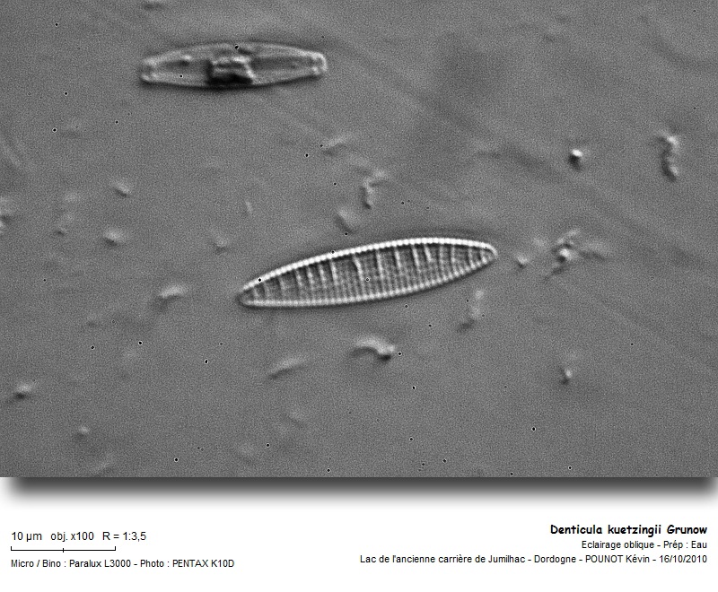 Denticula kuetzingii Grunow #18549