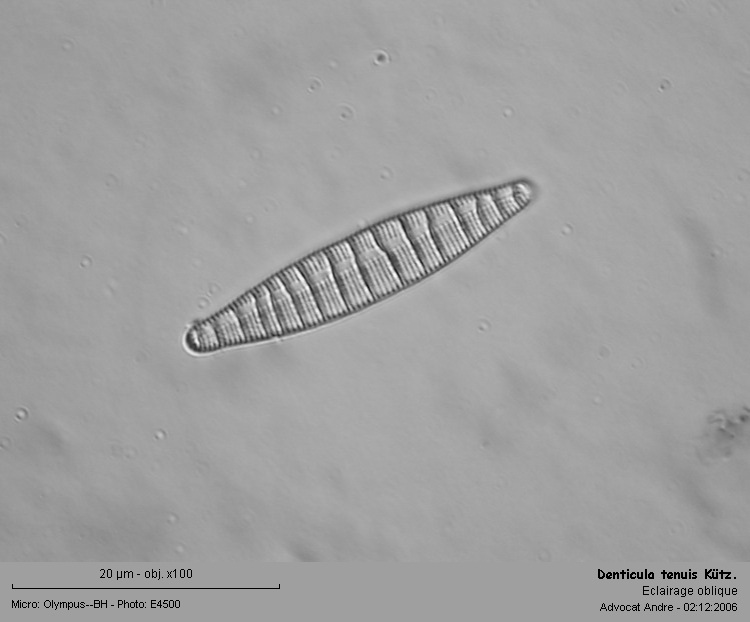 Denticula tenuis Kütz. #13630