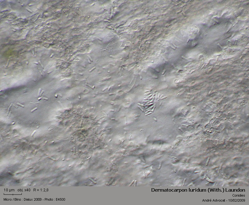 Dermatocarpon luridum (With.) Laundon #40063