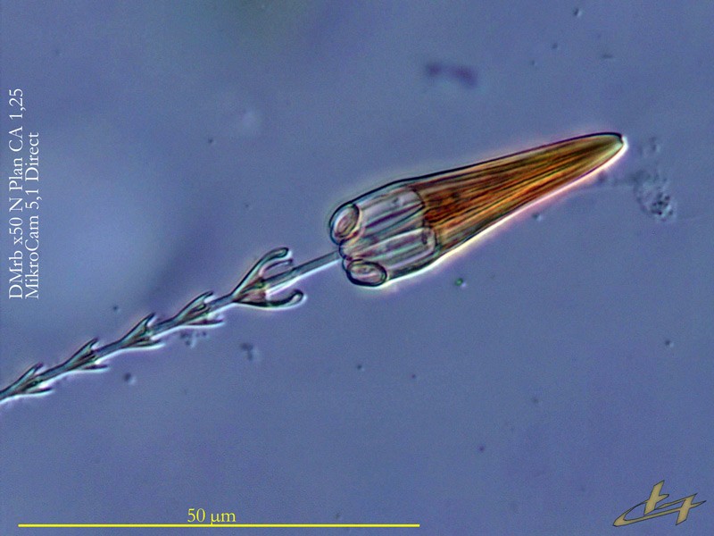 Dermestidae - Soies défensives - #85380
