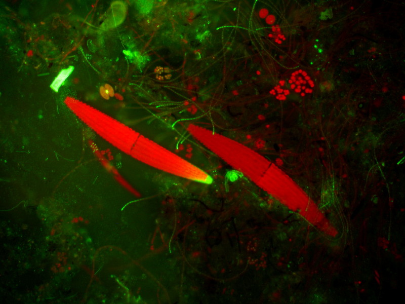 Desmidiées en epifluorecense #15955