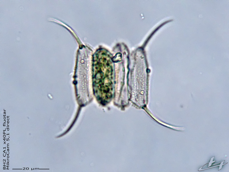 Desmodesmus armatus (Chodat) E. Hegewald 2000 #77920
