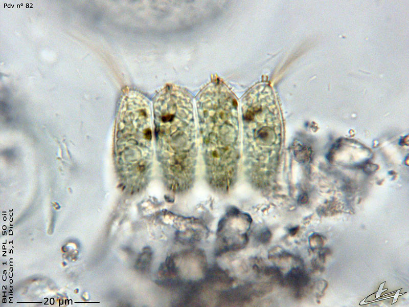 Desmodesmus armatus (Chodat) E. Hegewald 2000 #77918