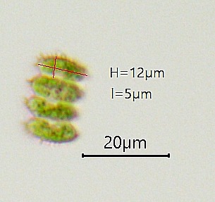 Desmodesmus serratus #76502