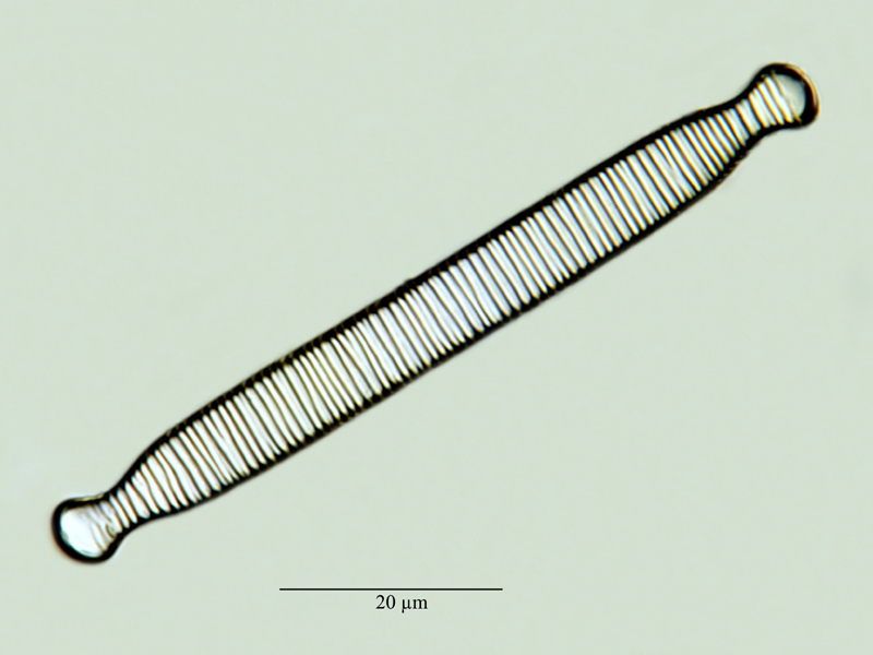 Diatoma ehrenbergii Kützing #24253