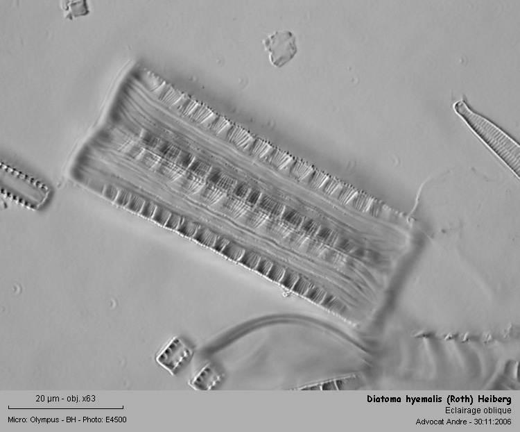 Diatoma hyemalis (Roth)Heiberg #1968