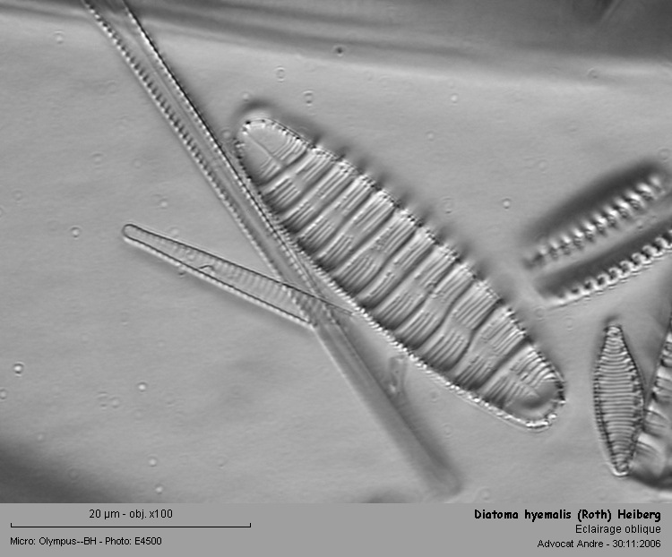 Diatoma hyemalis (Roth)Heiberg #1967