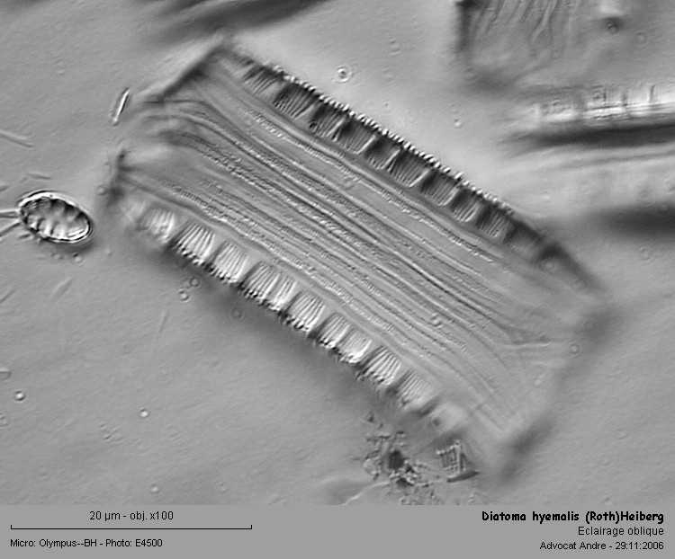 Diatoma hyemalis (Roth)Heiberg #1966