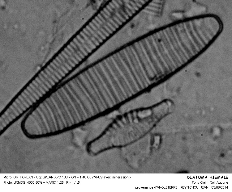 DIATOMA HYMALE var. QUADRATUM Kutzing. #37736