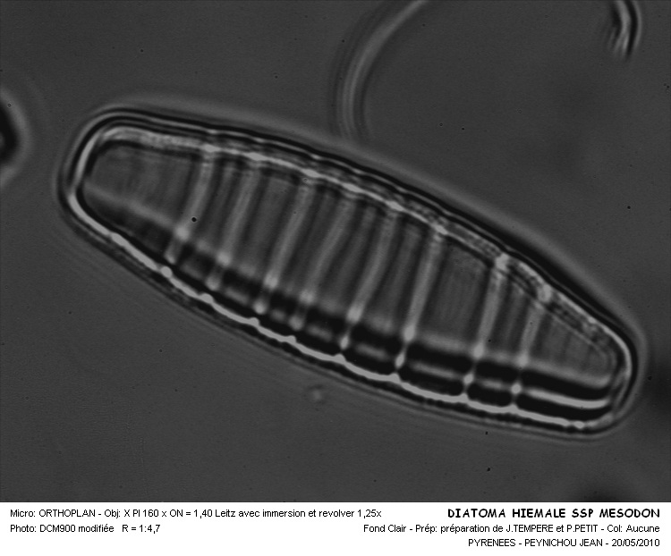 Diatoma mesodon (Ehr.) Kützing #16222