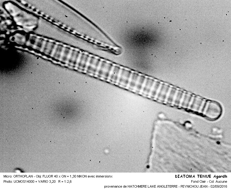 DIATOMA TENUE Agardh #46746