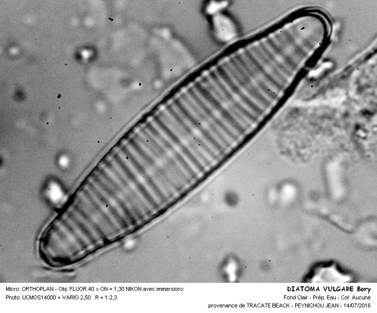 DIATOMA VULGARE Bory #46107