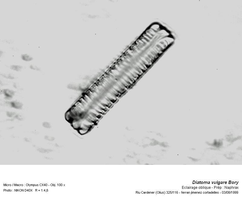 Diatoma vulgare Bory #14821
