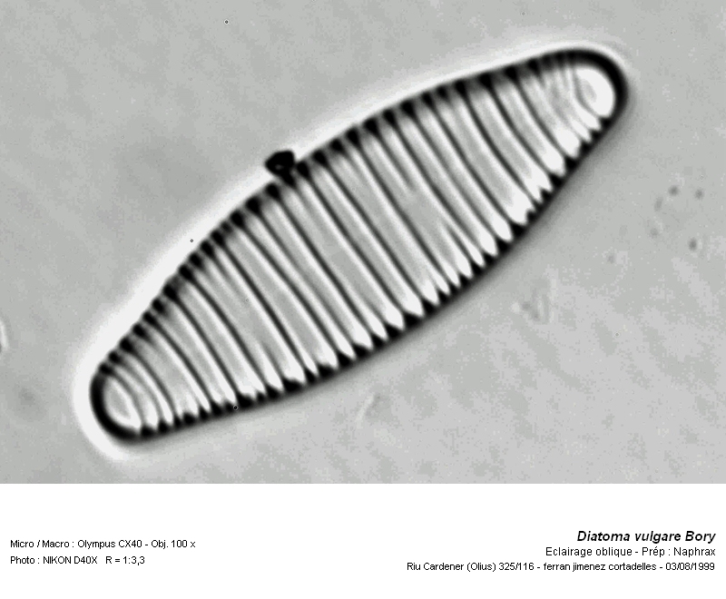Diatoma vulgare Bory #14816